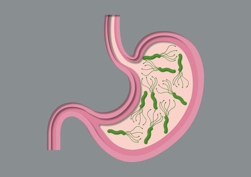 Helicobacter stomach infection, conceptual illustration