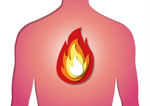 Heartburn, conceptual illustration