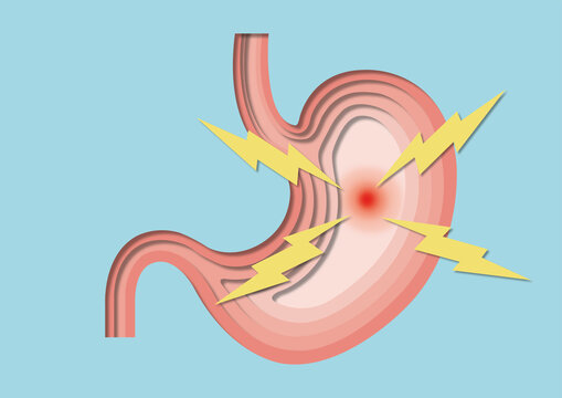 Stomach pain, conceptual illustration