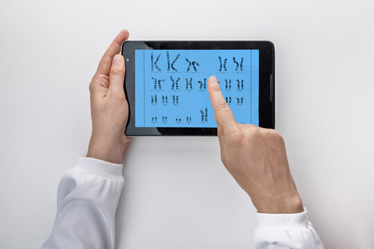 Genetic test and hereditary disease diagnostics. Doctor hands holding tablet displaying human karyotype chromosomal analysis.