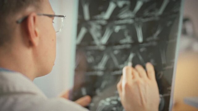 During diagnostic imaging review in a medical office, the doctor scrutinizes MRI scans and X-ray films, pinpointing fracture details to ensure an accurate diagnosis and devise a treatment plan