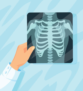 Hand holding xray. Chest lungs radiography, doctor hands holding x ray film diagnosis exam patient roentgen medic radiology patient health check healthcare neat vector illustration
