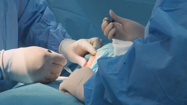 Surgical Team Hands Performing Incision with Scalpel and Forceps During Operation