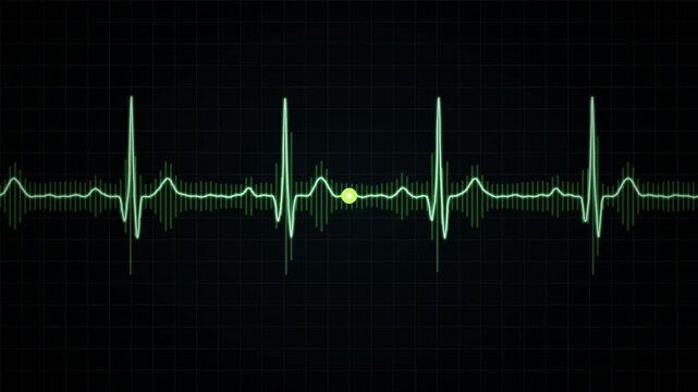 Green ECG heartbeat monitor line animation on dark grid