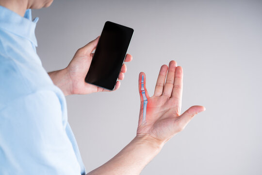 Finger curvature and hand pain from using mobile phone. Illustration anatomical bones little finger. Smartphone syndrome and excessive screen time