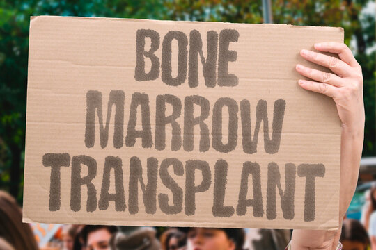 "Bone marrow transplant" Stem cell bone marrow transplant can cure certain types of leukemia permanently. BONE. MARROW. TRANSPLANT. CURE. LEUKEMIA.