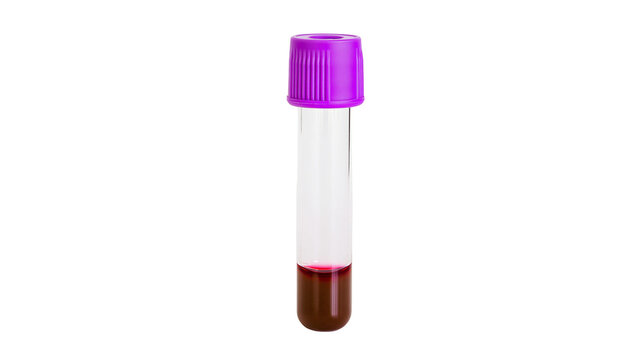 Isolated single blood sample test tube with purple cap and red liquid for medical lab