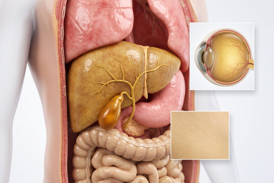 Jaundice Concept: Liver, Eye and Skin Yellowing, 3D Illustration
