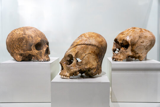 elongated human skulls on white background. Bone texture visible. Artificial cranial deformation. Ancient burial artifacts. Front and side views.
