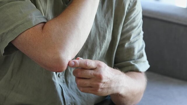 Man using curative topical cream or ointment to affected hand elbow to help from dermatitis, dry patches or psoriasis discomfort. Home skin care medical treatment concept.