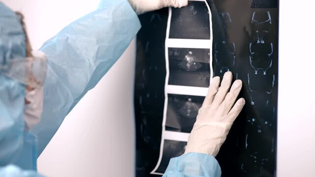 Doctor Pointing Hand In Gloved Finger At MRI CT Scan Film And Ultrasound Printouts. Medical Radiologist Analyzing Diagnostic Brain Images