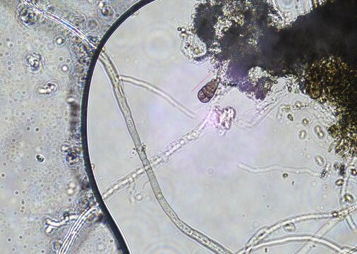 soil microorganisms under a microscope including amoeba, flagellates, nematodes, fungi, bacteria	