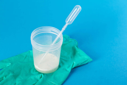 A sperm container on a green medical glove. Concept of ejaculate microscopy for motile sperm. Sperm acidity and leukocytes. Copy space for text