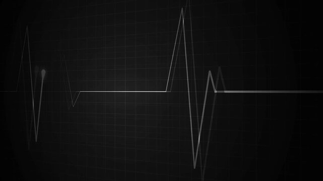 Heartbeat monitor line on a grid with a flat pulse and sharp spikes animation, showing a medical emergency or heartbeat concept
