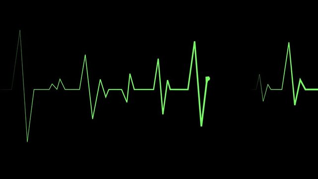 Heartbeat line electrocardiogram pulse pattern medical and health concept animation