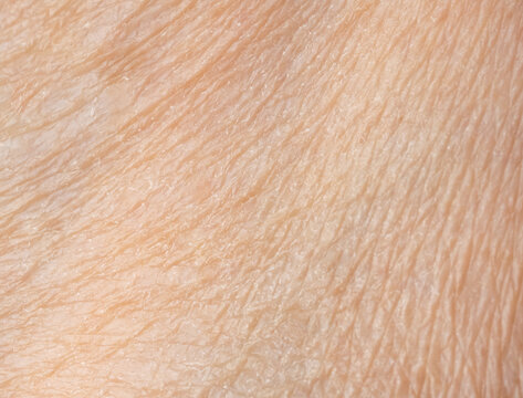 Macro texture of dry human skin, flaky epidermis closeup view, wrinkled body skin rough detail