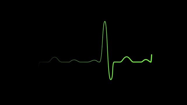 Minimal heartbeat line medical pulse graph with a sharp spike and calm empty space animation