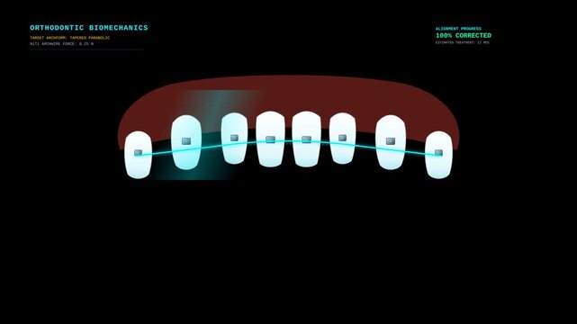 Orthodontic Biomechanics Animation Showing Tooth Alignment Process with Braces and Archwire Force