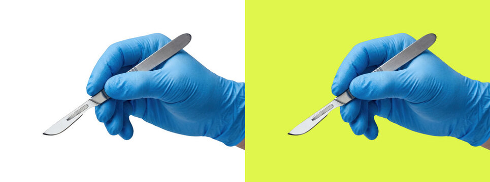 Surgeon hand in blue glove holding metal scalpel