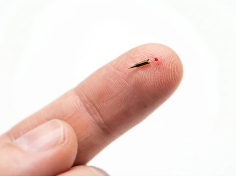 Splinter in finger with small wound isolated on white background