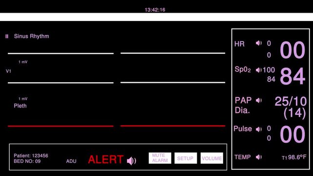 Hospital patient monitor screen showing vital signs and flatline heart rate with active medical alert warning sign in a dark clinical room environment for healthcare and emergency medicine concept