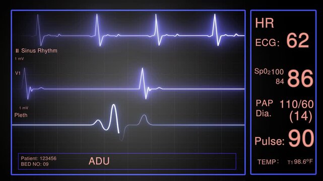 Medical hospital monitor screen showing heart rate ecg wave and vital signs with blue and orange digital data display for patient health tracking in an intensive care unit room during clinical checkup