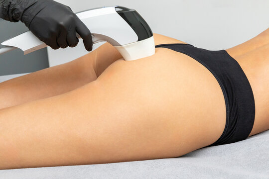 Close up female technician performs laser treatment on unrecognizable client's thigh using a handheld device in a modern beauty clinic Body treatment, profound cellulite reduction.