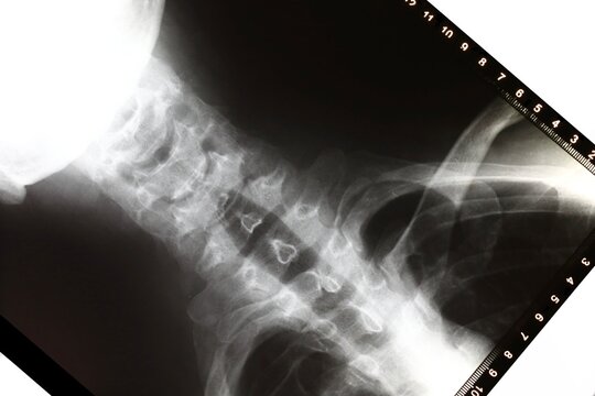 Medical image, x-ray of human body