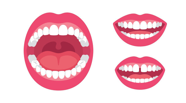Teeth anatomy and oral health dental vector illustration showing healthy smile and gap closure concepts.
