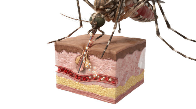 Mosquito Bite Infection Mechanism in Human Skin Medical Cutaway Illustration