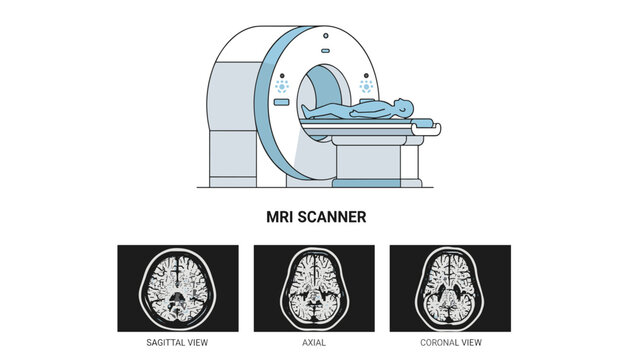 MRI scanner vector illustration with brain scan views of sagittal axial and coronal planes