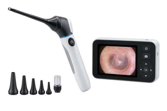 Digital ear examination camera with interchangeable probe tips and eardrum view
