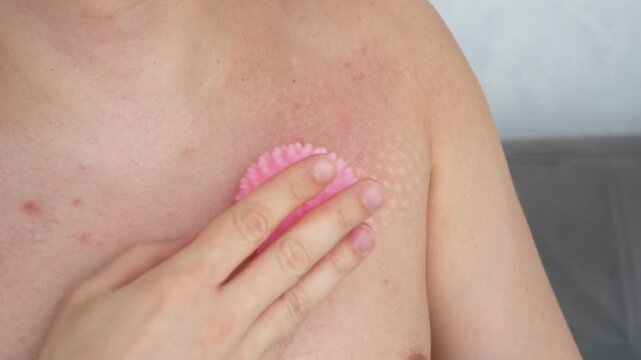 Body massage with a special ball.
Reduces swelling and improves blood circulation.
