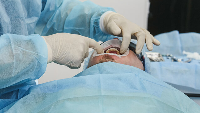 Dentist placing silicone mouth retractor on patient and examining teeth with dental mirror, close-up oral examination without visible face