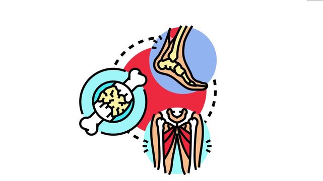 Vector depicting various examples of long term traumatic aftereffects, including musculoskeletal injuries, bone degradation, and chronic pain conditions affecting human body health
