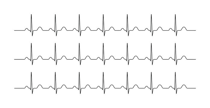 Three rows of black heartbeat ekg lines on a white background