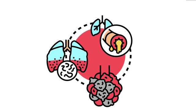 Lung infection disease concept bronchial inflammation, pneumonia, and damaged alveoli, showing symptoms of illness and medical condition