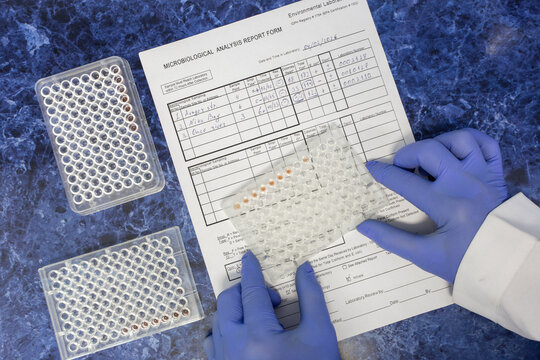 The scientist records the results of the enzyme immunoassay from the immunological plate into the laboratory protocol.