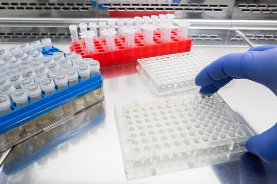 A scientist in a gloved hand holds an immunological plate showing an agglutination reaction, amidst boxes of test tubes on a laboratory bench.