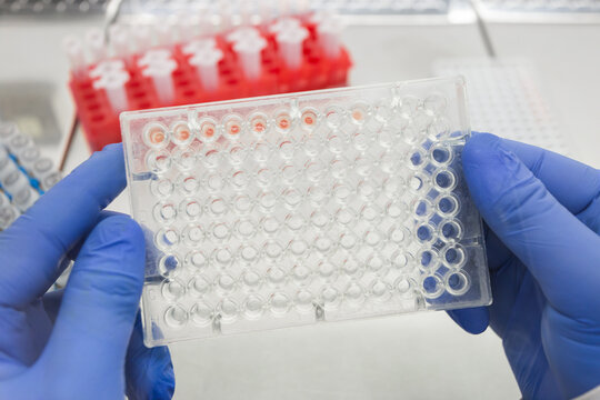 A scientist is analyzing an immunological test for the antibody response to a pathogen using a human blood sample. A test for the immunological response to a pathogen.