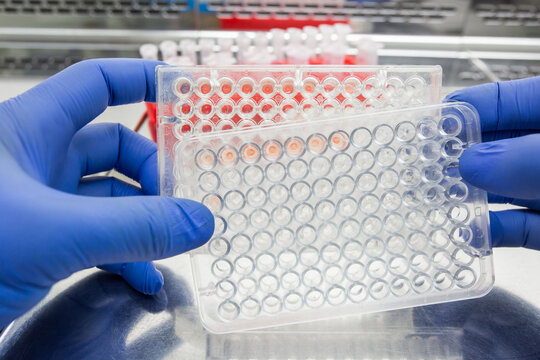 A doctor holds two immunological plates showing agglutination reactions in front of themselves. They compare the reaction results on the different plates.