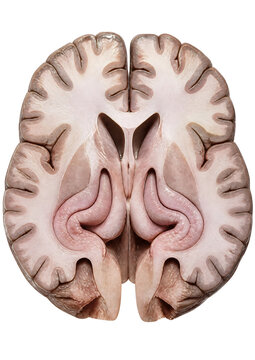 Hippocampus Anatomy in the Human Brain