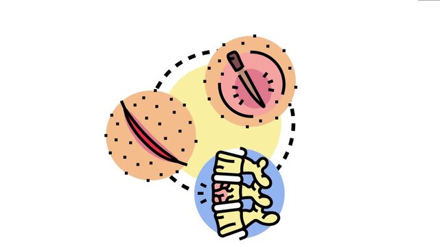 Major wound concept showing a deep skin cut, a surgical instrument operating, and a damaged spinal column, representing medical treatment and bodily trauma
