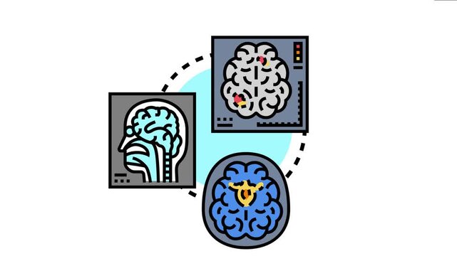 Medical imaging technology providing detailed views of internal body structures, visualizing a human head and brain with highlighted areas for diagnostic analysis