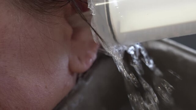 Close-up of ear irrigation procedure showing water flowing from a syringe into a basin, highlighting the process of cleaning the ear canal with visible water splashes and skin details