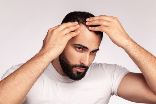 Guy examining receding hairline on forehead while touching scalp to check hair loss progress and skin condition during beauty session isolated over gray background