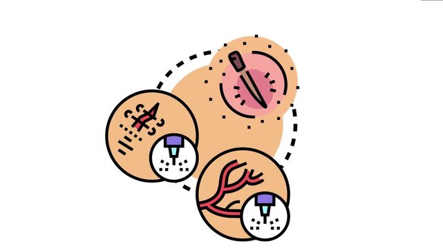 Microwave wound therapy concept presenting medical treatment process, healing skin injury, stimulating tissue regeneration, and blood vessel growth using specialized instrument application