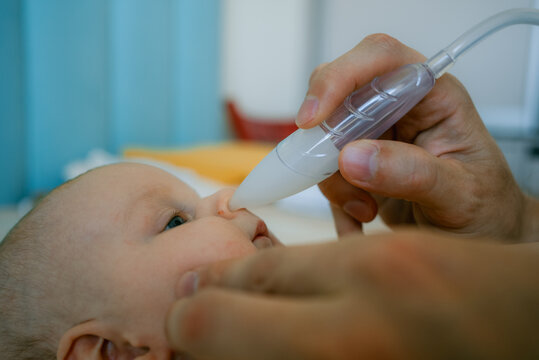 Parent carefully using a manual nasal aspirator to remove mucus from a baby's blocked nose, supporting infant respiratory health and providing essential newborn care for congestion