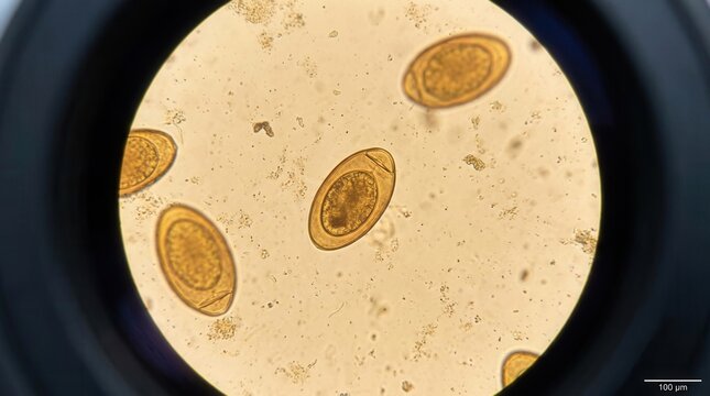 Microscopic View Of Parasitic Eggs Under High Magnification And Biomedical Science