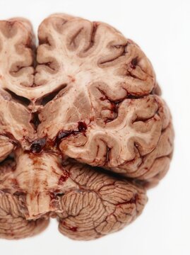 Detailed Close-Up View Of Human Brain Section Scientific Medical Study